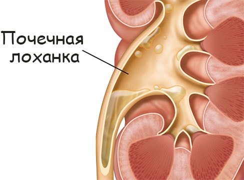 Замена гидры